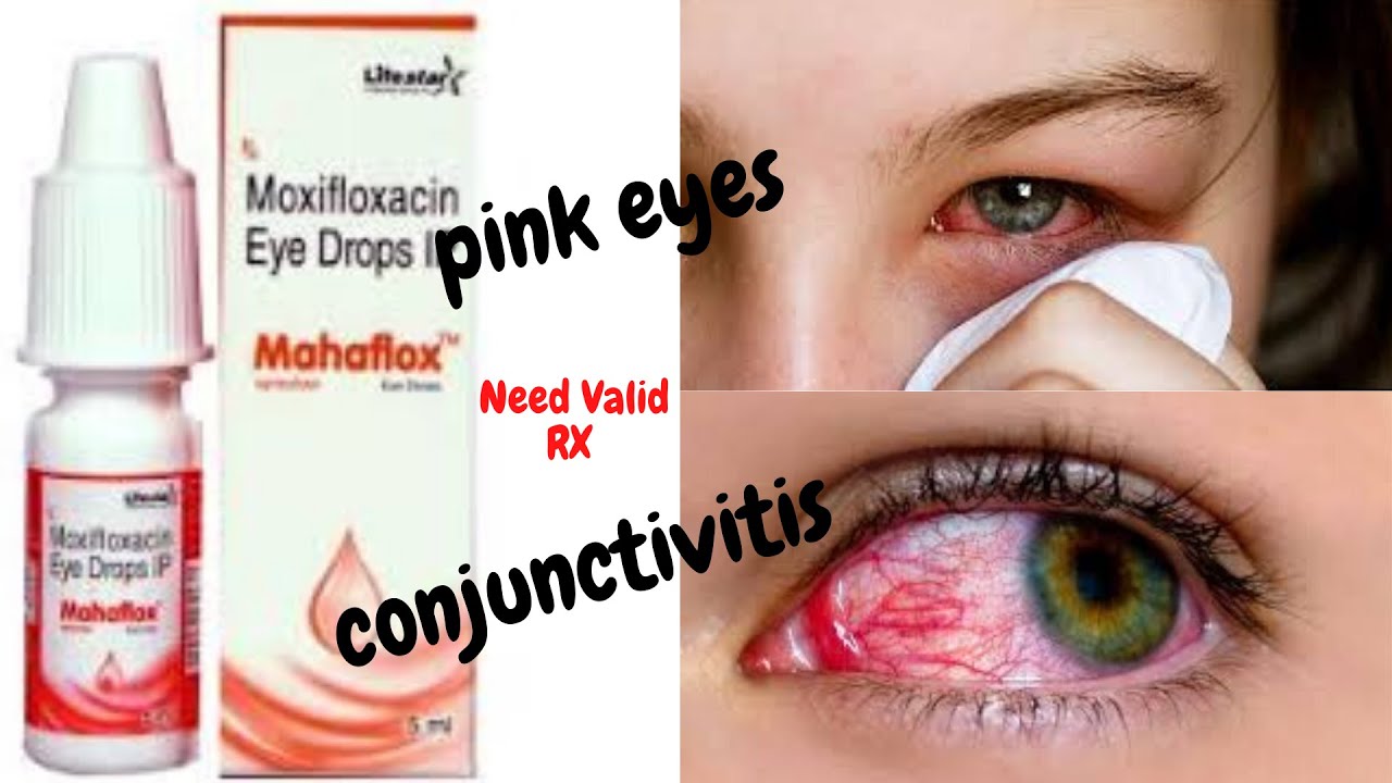 Conjunctivitis medication