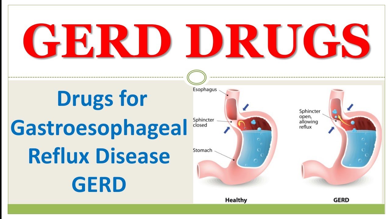 Gastroesophageal reflux disease medication